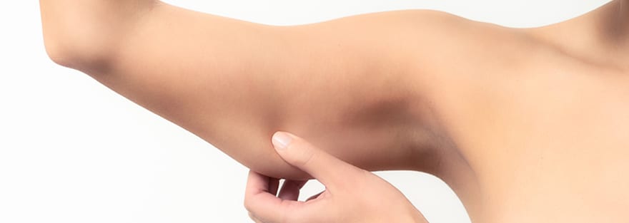 Arm Lift | Brachioplasty | Green Hills Plastic Surgery | Nashville