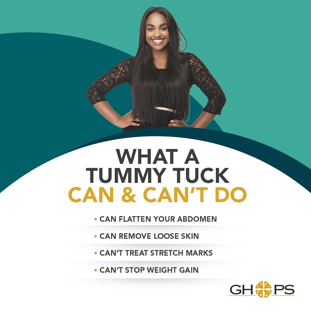 What A Tummy Tuck Can & Can't Do [Infographic] img 1