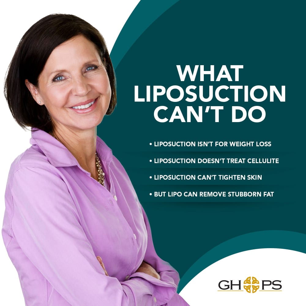 What Liposuction Can't Do [Infographic] img 1