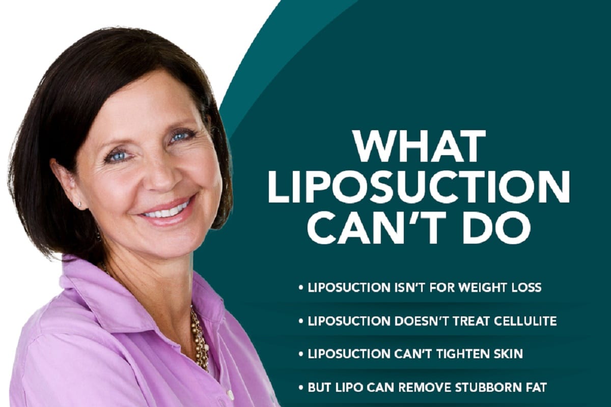 What Liposuction Can't Do [Infographic]
