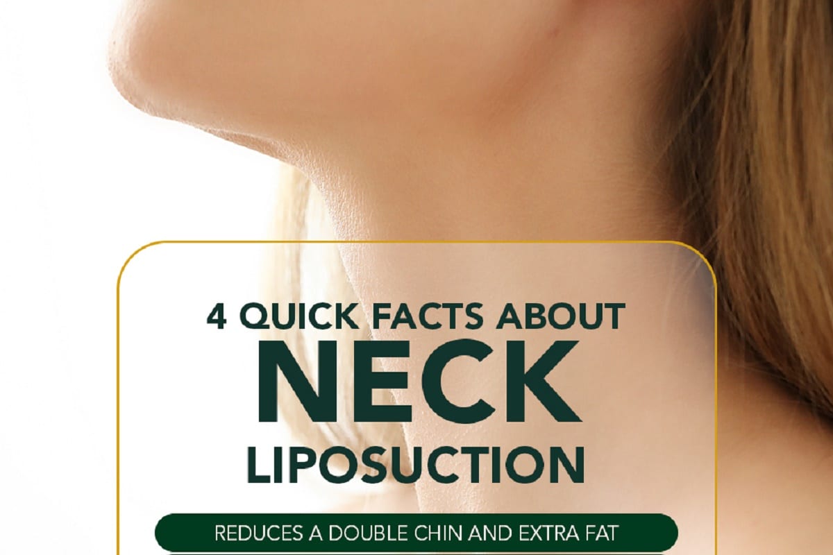 4 Quick Facts About Neck Liposuction [Infographic]